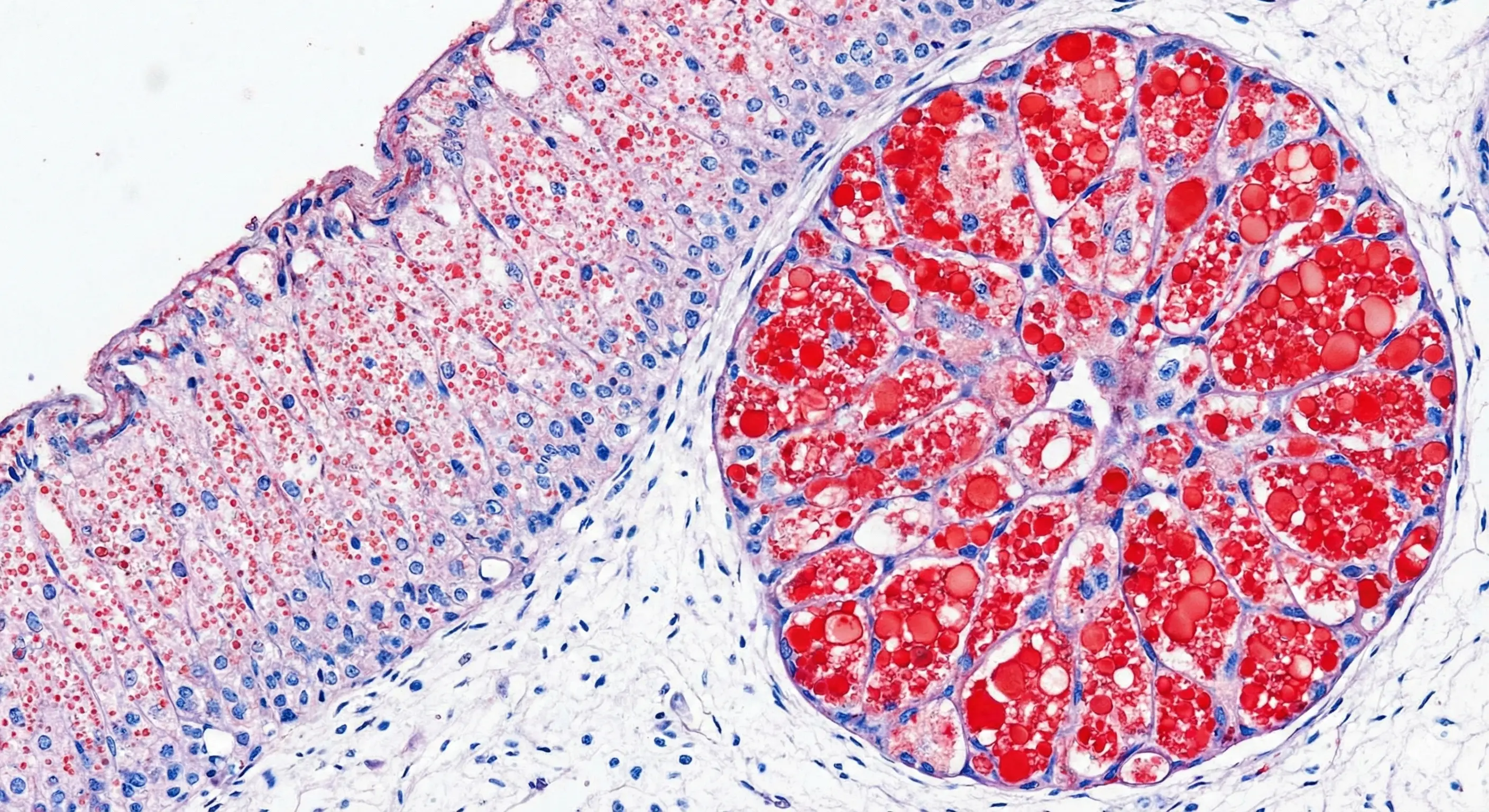 Adrenal Disorders