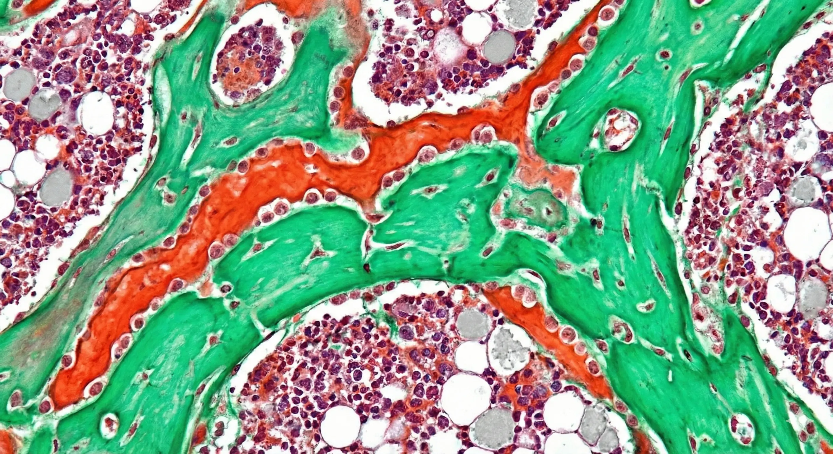 Bone and mineral disorders